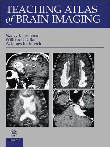 Stock image for Teaching Atlas of Brain Imaging (Teaching Atlas Series) for sale by HPB-Red