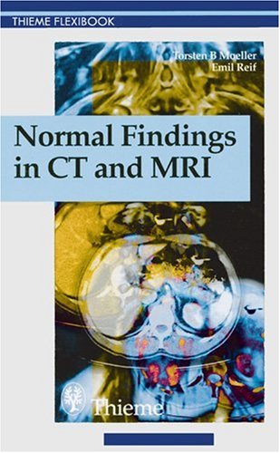 Stock image for Normal Findings in Ct and Mri (Thieme Flexibook) for sale by Front Cover Books