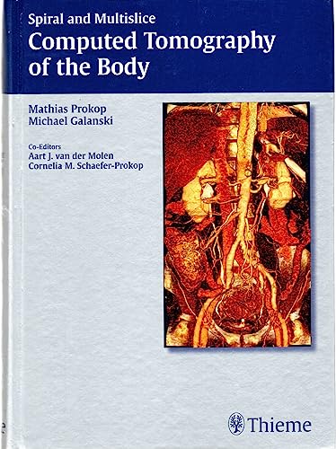 Stock image for Spiral and Multislice Computed Tomography of the Body for sale by GF Books, Inc.