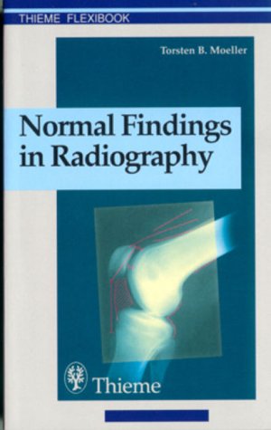 Imagen de archivo de Normal Findings in Radiography a la venta por Better World Books