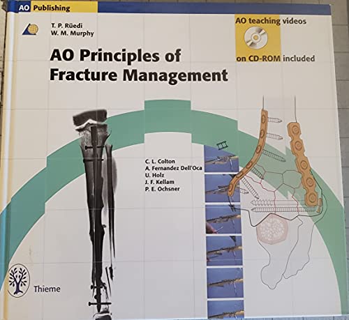 Beispielbild fr Principles of Fracture Management zum Verkauf von ThriftBooks-Dallas