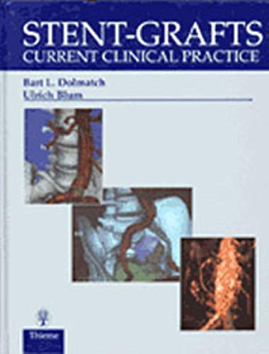 Stock image for Stent-Grafts : Current Clinical Practice for sale by Better World Books