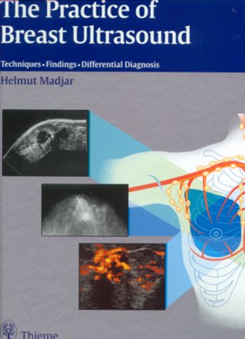 9780865778986: The Practice of Breast Ultrasound: Techniques, Findings, Differential Diagnosis