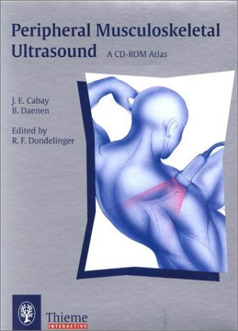 Peripheral Musculoskeletal Ultrasound: A CD-ROM Atlas (9780865779037) by Dondelinger, Robert
