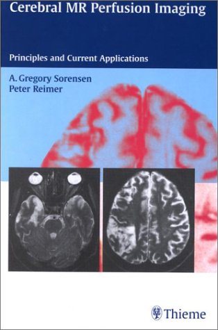 Cerebral MR Perfusion Imaging: Book + CD-ROM Set: Principles and Current Applications (9780865779259) by Sorensen, A. Gregory; Reimer, Peter