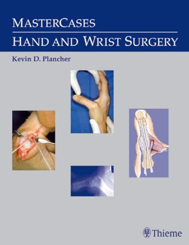 9780865779815: MasterCases in Hand and Wrist Surgery