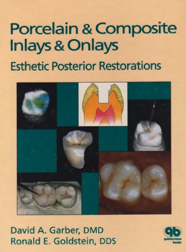 9780867151718: Porcelain and Composite Inlays and Onlays: Aesthetic Posterior Restorations