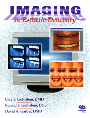 Stock image for Imaging in Esthetic Dentistry for sale by AwesomeBooks