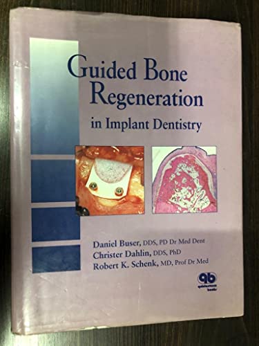 Stock image for Guided Bone Regeneration in Implant Dentistry for sale by HPB-Red