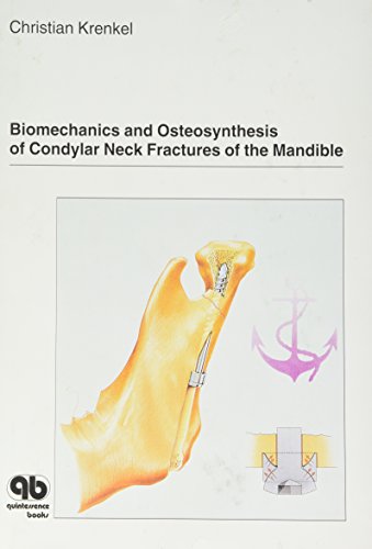 9780867152647: Biomechanics and Osteosynthesis on Condylar Neck Fractures of the Mandible