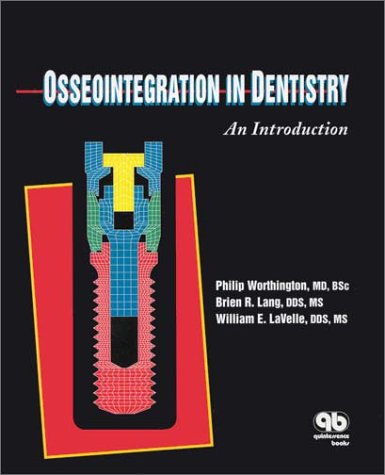Imagen de archivo de Osseo Integration in Dentistry: An Introduction a la venta por Ammareal