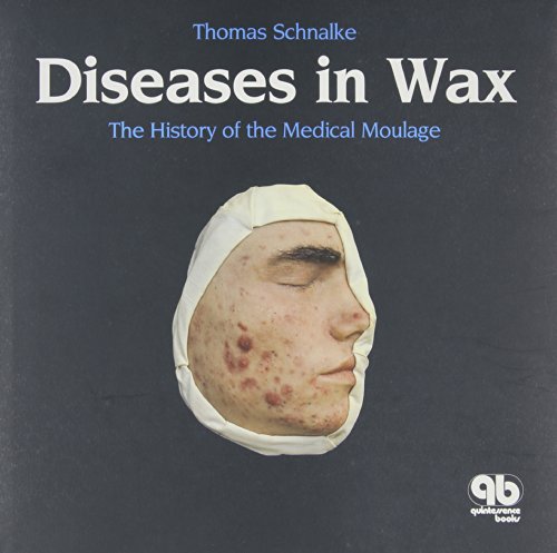 Stock image for Diseases in Wax: the History of Medical Moulage for sale by Books Puddle