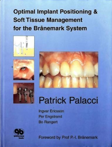 Beispielbild fr Optimal Implant Positioning & Soft Tissue Management for the Branemark System zum Verkauf von Patrico Books