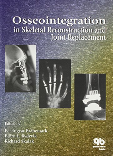 Stock image for Osseointegration in Skeletal Reconstruction and Joint Replacement for sale by Mispah books
