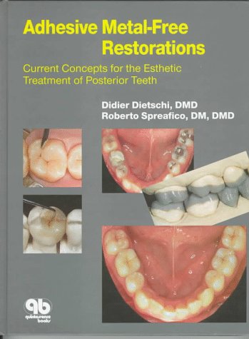 Imagen de archivo de Adhesive Metal-Free Restorations: Current Concepts for the Esthetic Treatment of Posterior Teeth a la venta por Front Cover Books
