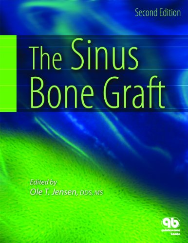 Beispielbild fr The Sinus Bone Graft zum Verkauf von ThriftBooks-Dallas