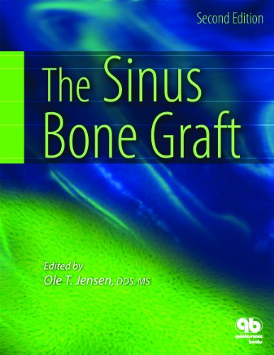 Imagen de archivo de The Sinus Bone Graft a la venta por HPB-Red