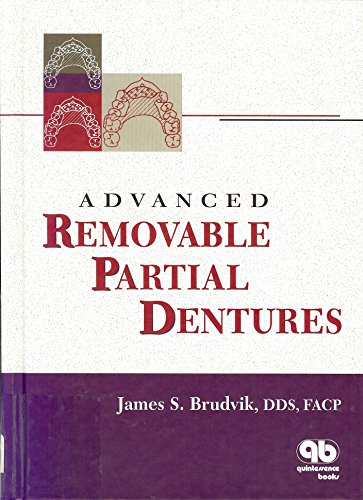 9780867153514: Advanced Removable Partial Dentures