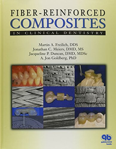 Fiber-Reinforced Composites