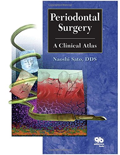 9780867153774: Periodontal Surgery: A Clinical Atlas