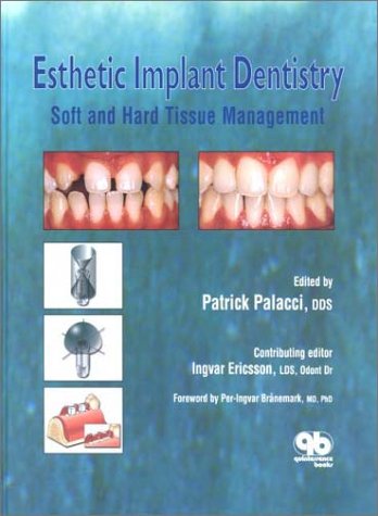 Beispielbild fr Esthetic Implant Dentistry: Soft and Hard Tissue Management zum Verkauf von Dream Books Co.