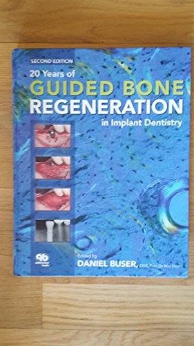 Stock image for 20 Years of Guided Bone Regeneration in Implant Denistry for sale by Books of the Smoky Mountains