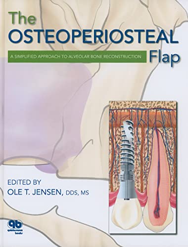 9780867154184: The Osteoperiosteal Flap: A Simplified Approach to Alveolar Bone Reconstruction