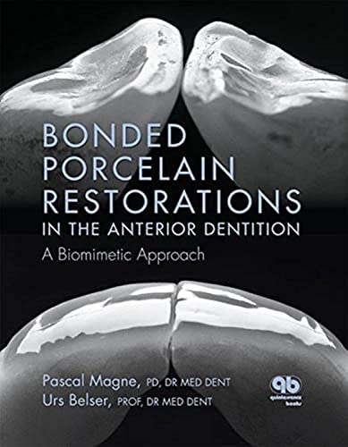 Bonded Porcelain Restorations in the Anterior Dentition: A Biomimetic Approach (9780867154221) by Magne, Pascal; Belser, U.