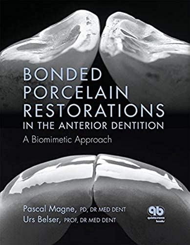 9780867154221: Bonded Porcelain Restorations in the Anterior Dentition: A Biomimetic Approach