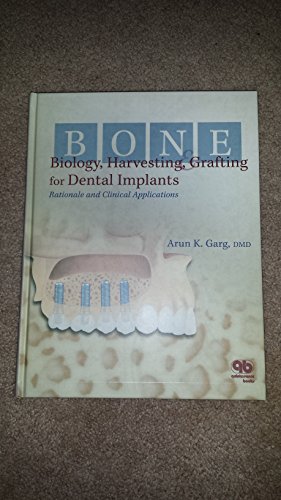Beispielbild fr Bone Biology, Harvesting, & Grafting For Dental Implants: Rationale and Clinical Applications zum Verkauf von BooksRun