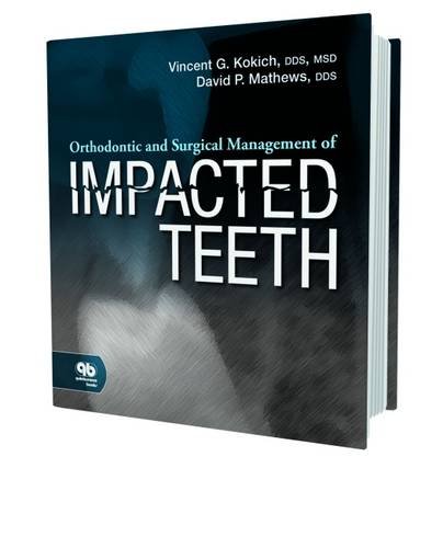 9780867154450: Orthodontic and Surgical Management of Impacted Teeth