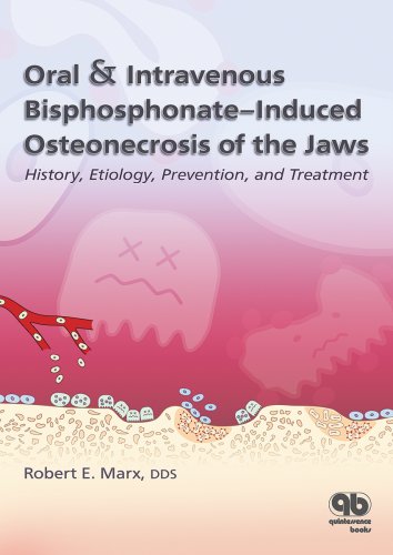 Beispielbild fr Oral & Intravenous Bisphosphonate-Induced Osteonecrosis of the Jaws: History, Etiology, Prevention, and Treatment zum Verkauf von BooksRun