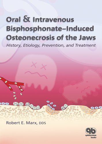 Stock image for Oral & Intravenous Bisphosphonate-Induced Osteonecrosis of the Jaws: History, Etiology, Prevention, and Treatment for sale by BooksRun