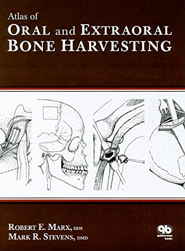 Stock image for Atlas of Oral and Extraoral Bone Harvesting for sale by Book Deals