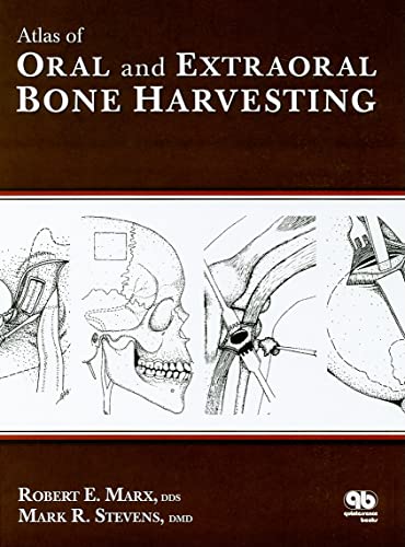 9780867154825: Atlas of Oral and Extraoral Bone Harvesting