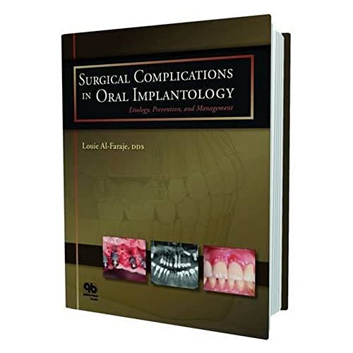 9780867155068: Surgical Complications in Oral Implantology: Etiology, Prevention, and Management