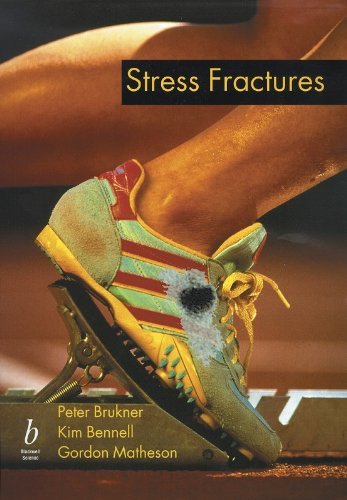 Beispielbild fr Stress Fractures zum Verkauf von Anybook.com