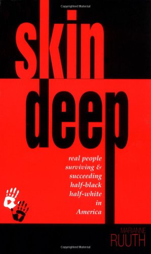 Beispielbild fr Skin Deep: Real People Surviving & Succeeding Half-Black Half-White in America zum Verkauf von JERO BOOKS AND TEMPLET CO.