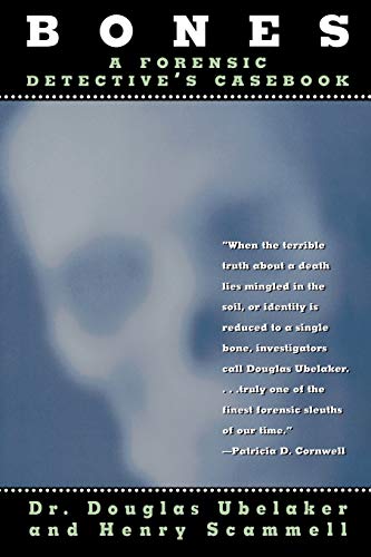 9780871319043: Bones: A Forensic Detective's Casebook