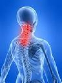 Stock image for Neck Pain for sale by HPB-Red
