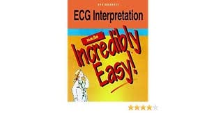 Imagen de archivo de ECG Interpretation Made Incredibly Easy a la venta por Wonder Book