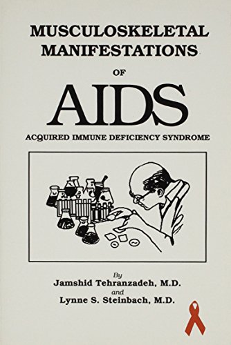9780875275093: AIDS: Musculoskeletal Manifestations