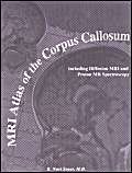 Stock image for MRI Atlas of the Corpus Callosum for sale by TextbookRush