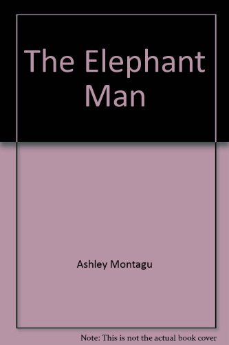 Imagen de archivo de The Elephant Man: A Study in Human Dignity a la venta por Irish Booksellers