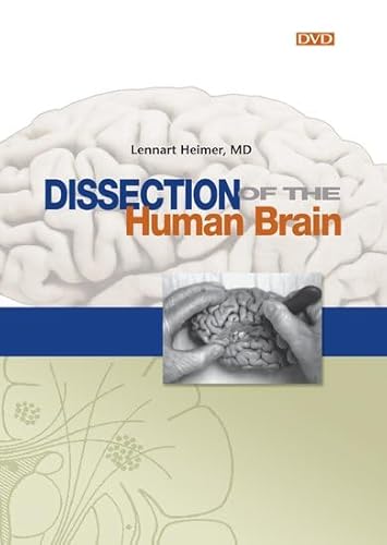 Imagen de archivo de Dissection of the Human Brain a la venta por Zoom Books Company