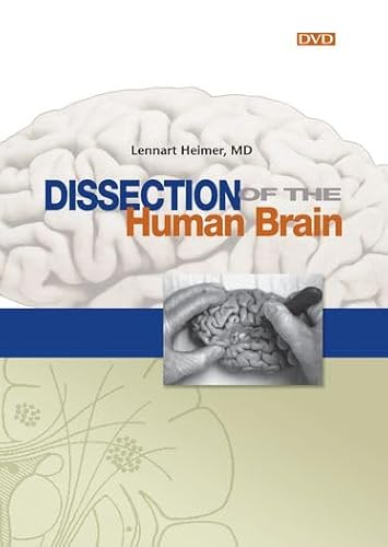 9780878933273: Dissection of the Human Brain
