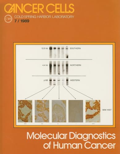 Stock image for Molecular Diagnostics of Human Cancer for sale by Better World Books