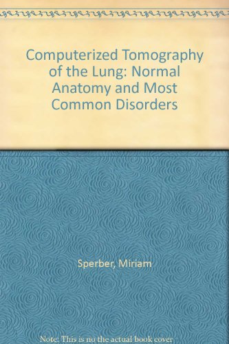 Computerized Tomography of the Lung: Normal Anatomy and Most Common Disorders (9780879932091) by Sperber, Miriam