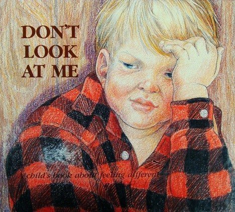 Imagen de archivo de Dont Look at Me: A Childs Book about Feeling Different (Hurts of Childhood Series) a la venta por Red's Corner LLC