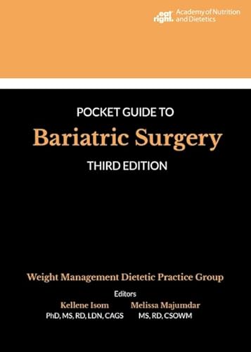 Beispielbild fr Pocket Guide to Bariatric Surgery zum Verkauf von Blackwell's
